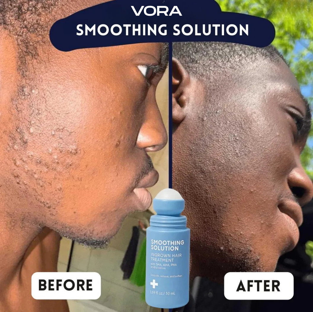 Vora Anti-Bump Serum