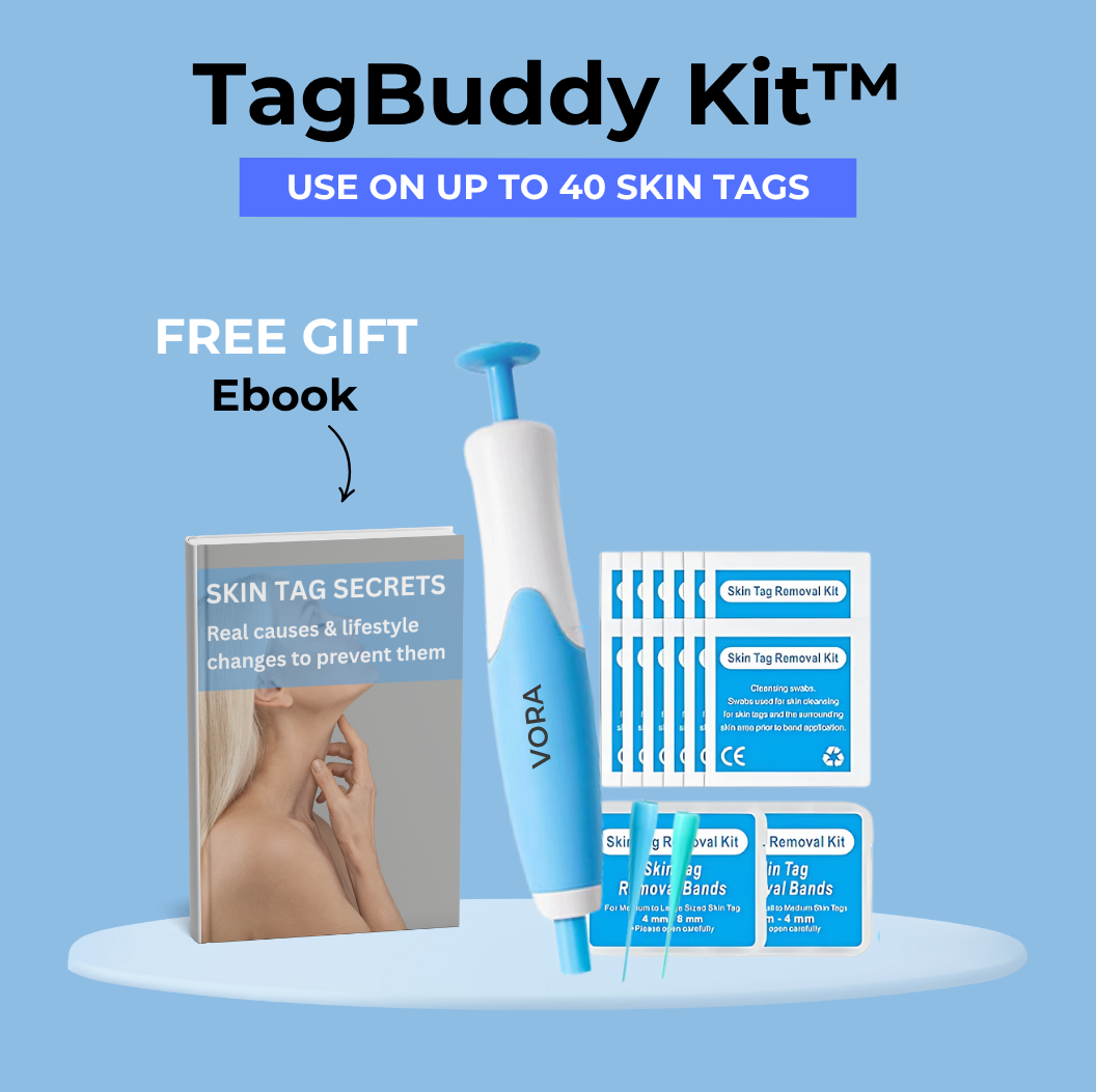 TagBuddy Kit – For Clearer Looking Skin at Home
