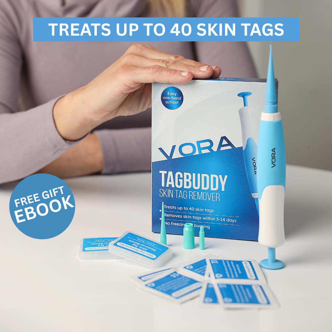 TagBuddy Kit - No More Skin Tags