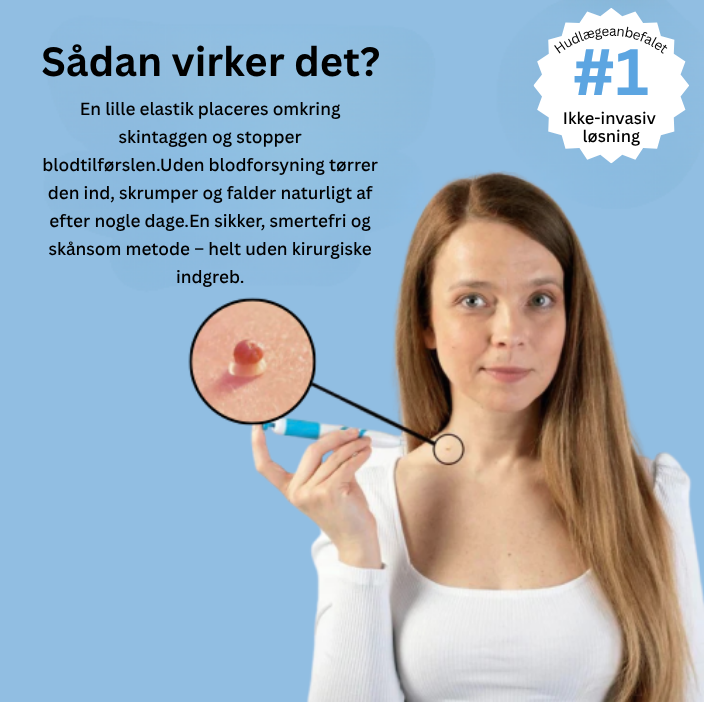 TagBuddy Kit - Slut med skin tags
