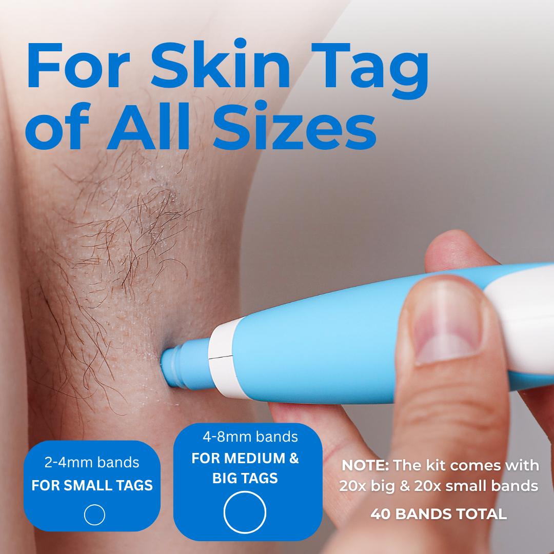 TagBuddy Kit – For Clearer Looking Skin at Home