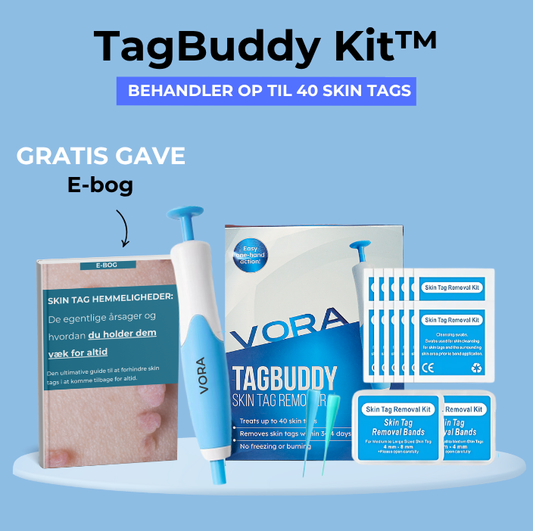 TagBuddy Kit - Slut med skin tags
