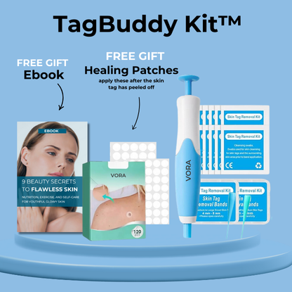 TagBuddy Kit™ - No More Skin Tags