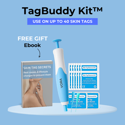 TagBuddy Kit – For Clearer Looking Skin at Home