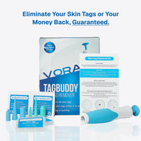 TagBuddy Kit - No More Skin Tags
