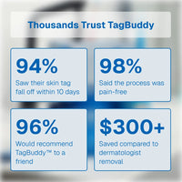 TagBuddy Kit - No More Skin Tags