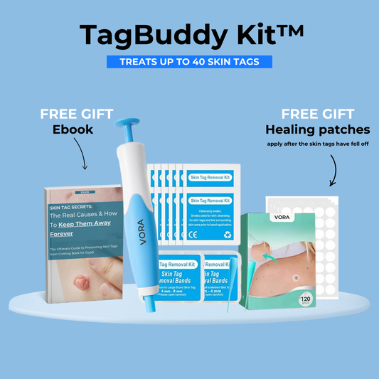TagBuddy Kit™ - No More Skin Tags